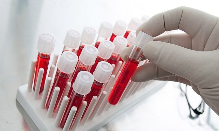 blood in vitro for analysis of a dog with prostatitis