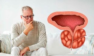 chronic prostate inflammation stage